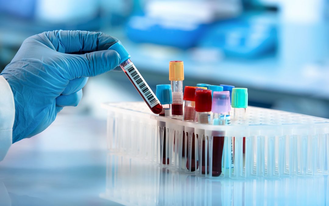 Analisi del sangue
